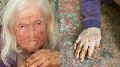 В Шымкенте 92-летняя пенсионерка живет в грязи с тараканами