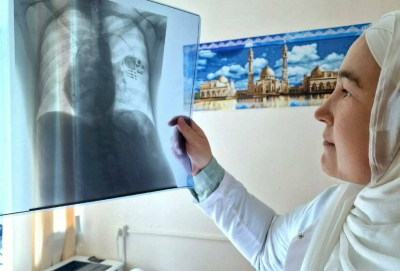 Врачи Челнов и Москвы спасли пациента, у которого сердце билось справа